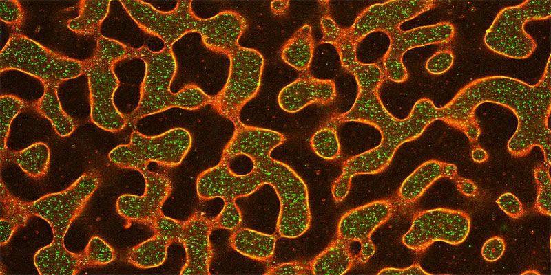 An optical fluorescence microscopy image of phase separated lipids